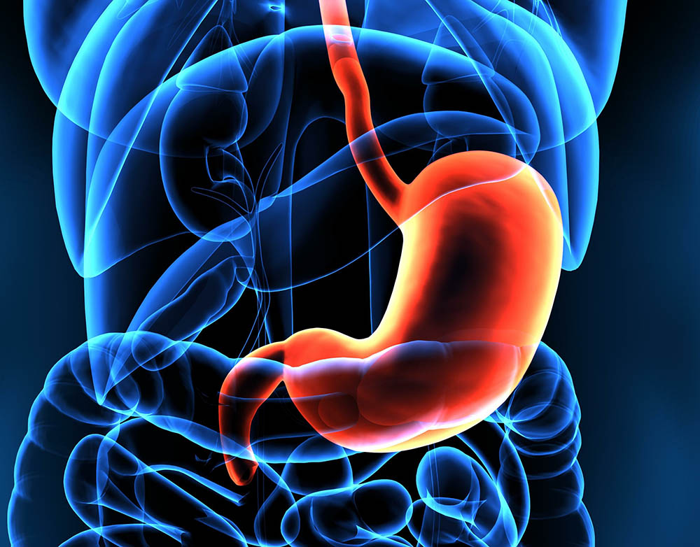 Stomach Cancer - United Digestive